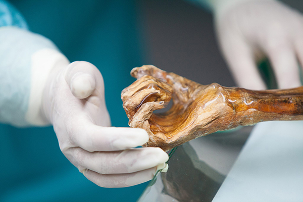 Otzi's hand