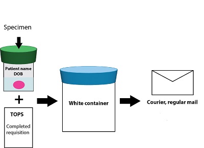 Please ensure that the biopsy specimen is placed promptly into the formalin fixative in the specimen bottle with a green lid, and that the bottle is securely closed. Please ensure that the specimen bottle is labeled with the patient’s full name as well as the dentist’s name.  Include completed requisition form. Please ensure that the patient’s name on the bottle matches exactly with the name provided on the requisition form.   Place the specimen bottle with the green lid in the provided plastic bag with zip-lock seal, wrap the requisition form on the outside of the plastic bag. Then, place the specimen package in the provided white container with a blue lid for shipping.