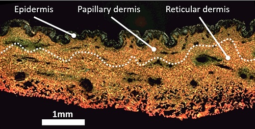 Representative localized AFM topological images (10 × 10 μm2) obtained from both the papillary and reticular dermal layers obtained directly on a polarised Sirius Red Stain histological section. The boundary between papillary and reticular dermal layers, denoted as a dashed line, was empirically set 500 μm below the epidermal junction.