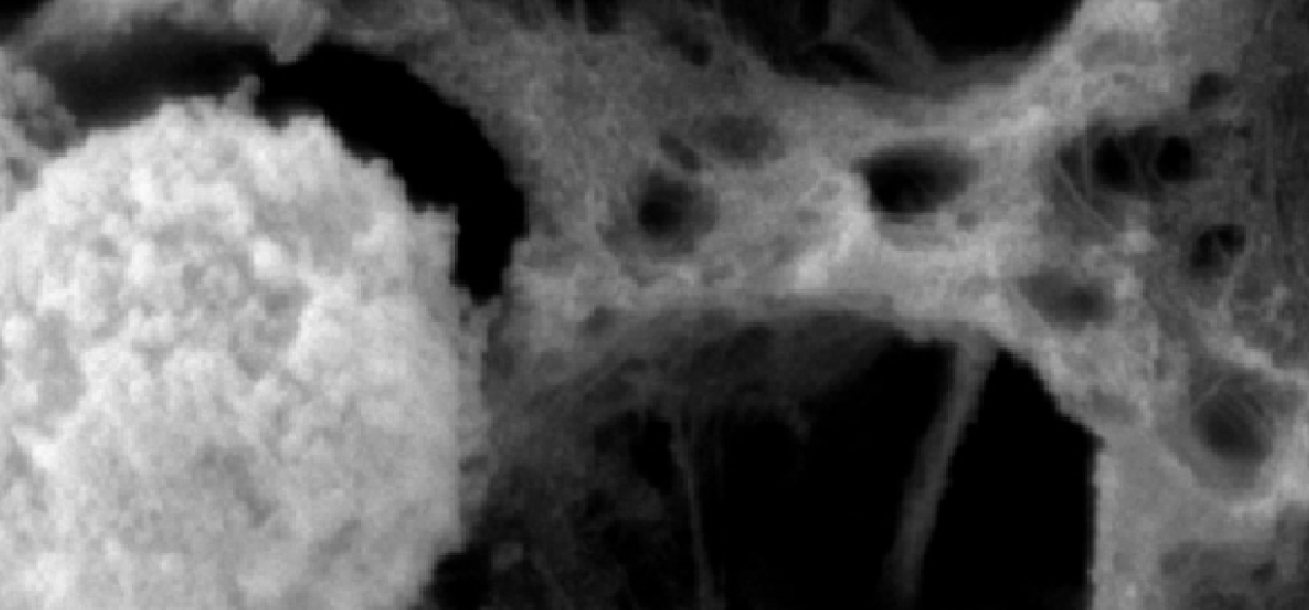 collagen after 24 hour incubation with neutrophils