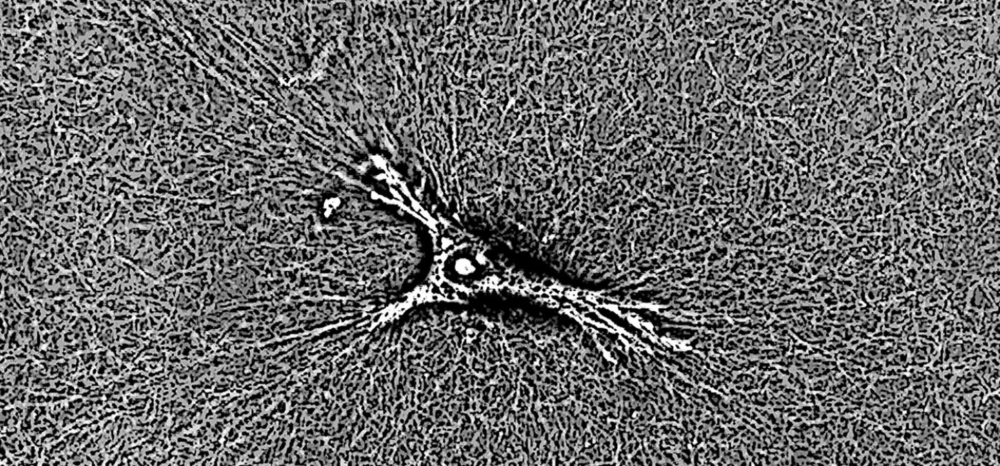 fibroblasts in extracellular matrix