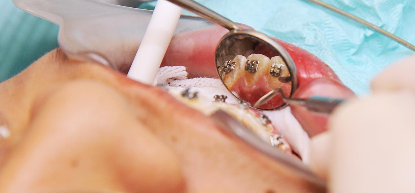 orthodontic procedure