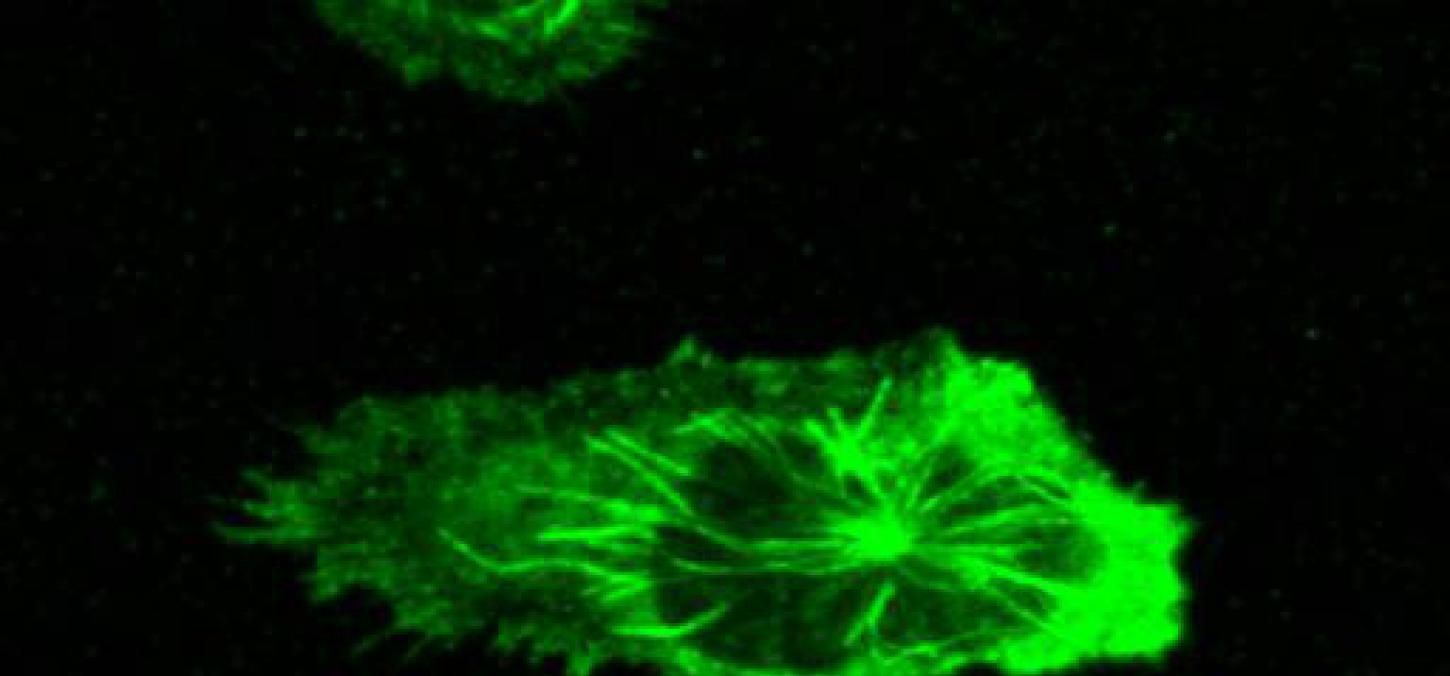 Neutrophils crawing dyed green against black 