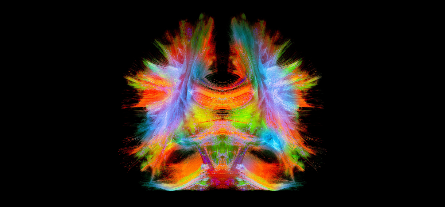 Full brain tractography with artistic color. This is a full brain tracking coming from a super-resolution reconstruction of 0.6 cubic mm. Front view.