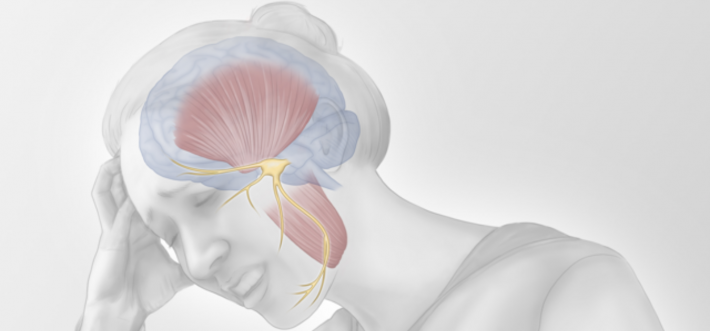 Illustration of TMD pain