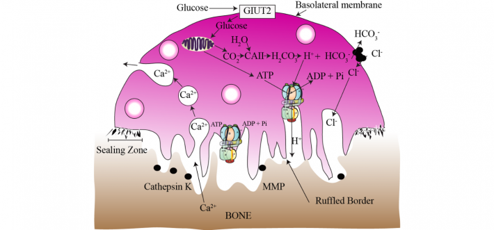 Illustration of dissolving bone