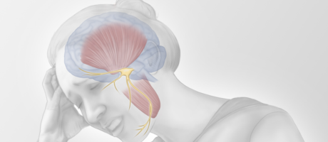 Illustration of TMD pain