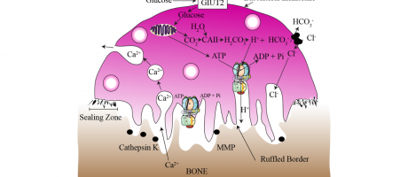 Illustration of dissolving bone