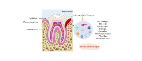 periodontist illustration